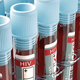 Image for article titled British Man Becomes the Second Person Ever to Be 'Functionally' Cured Of HIV